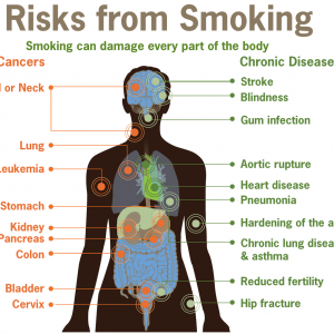 Wyndham Medical Clinic: 5 Tips to Quit Smoking